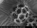 Pollen grain of Vernonia timorensis, Verheijen, JAJ, 4887, L.3644937