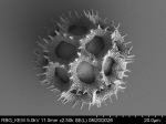 Pollen grain of Vernonia zollingerianoides, Altmann, H, 452, L.3660628