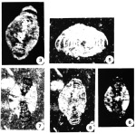 Radiospirillina umbonata Blau & Wernli, 1999