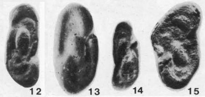 Kalosha oceanica Boltovskoy, 1978
