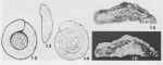 Ichnusella trocholinaeformis Dieni & Massari, 1966