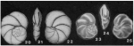 Epistominella evax Bandy, 1953