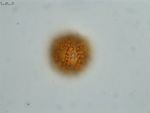 Pollen grain of Vernonia hispidula var. glabriuscula, Humbert, H., 3481, P00621427