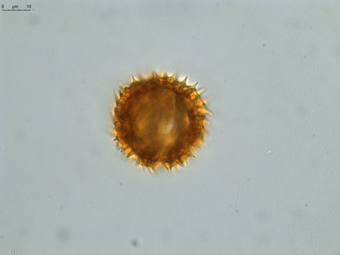 Pollen grain of Vernonia hispidula var. glabriuscula, Humbert, H., 3481, P00621427