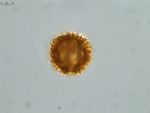 Pollen grain of Vernonia hispidula var. glabriuscula, Humbert, H., 3481, P00621427