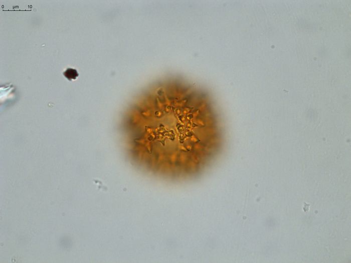 Pollen grain of Vernonia hispidula var. glabriuscula, Humbert, H., 3481, P00621427