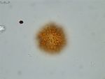 Pollen grain of Vernonia hispidula var. glabriuscula, Humbert, H., 3481, P00621427