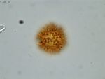 Pollen grain of Vernonia hispidula var. glabriuscula, Humbert, H., 3481, P00621427