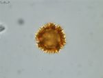 Pollen grain of Vernonia hispidula var. glabriuscula, Humbert, H., 3481, P00621427