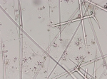 Holotype spicules