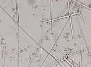 Holotype spicules