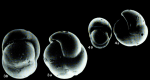 Pulleniella asymmetrica Ujiié, 1990