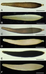 Pseudoconqueria lenticularis Holzmann, Gooday, Majewski & Pawlowski, 2022
