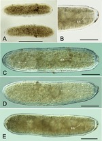 Limaxia alba Holzmann, Gooday, Majewski & Pawlowski, 2022