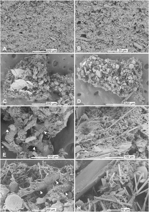 Fluxaphilia mollis Gooday, Ishitani, Chen, Richirt, Seike, Yamashita, Tsuchiya &amp; Nomaki, 2026