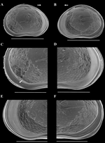 Holotype of Triangocypretta mariae Almeida, Martens & Higuti in Almeida, Correia, Martens & Higuti, 2025 from original description