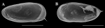 Holotype of Cypricercus alfredo Almeida, Ferreira, Higuti & Martens, 2021 from original paper