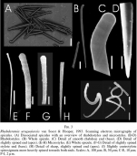 Rhabderemia uruguaiensis spicules