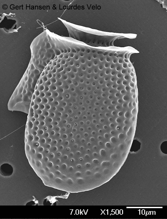 Dinophysis acuminata Dinophysis acuminata