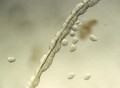 Hydrozoa (hydroids)