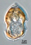 Azadinium spinosum, LM provided by Urban Tillmann