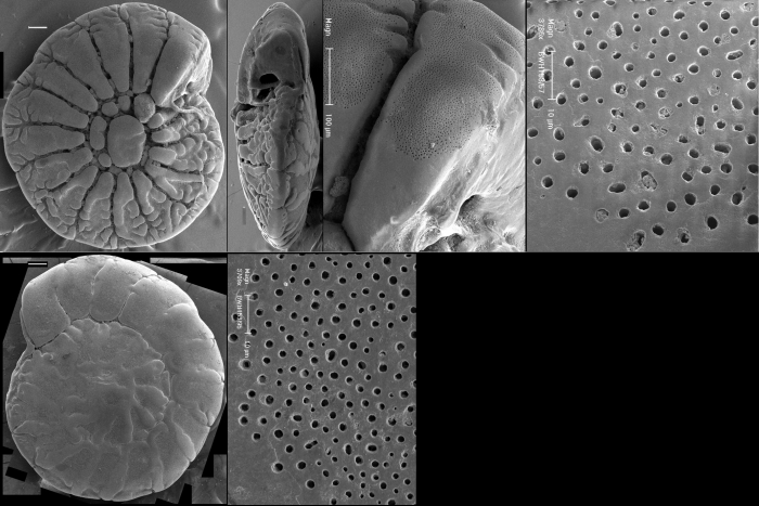 Ammonia beccarii, Adriatic, Rimini