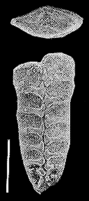 Rugobolivinella barcooae Rugobolivinella barcooae