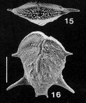 Chromista - Foraminifera (foraminifers)