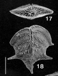 Chromista - Foraminifera (foraminifers)