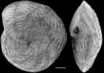 Chromista - Foraminifera (foraminifers)