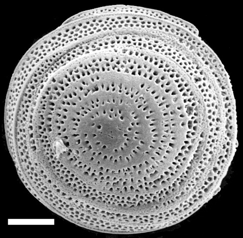 Neoconorbina cavalliensis NZ holotype Neoconorbina cavalliensis NZ holotype