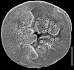 Chromista - Foraminifera (foraminifers)