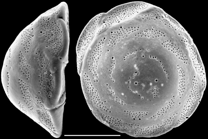 Pileolina patelliformis NZ Pileolina patelliformis NZ