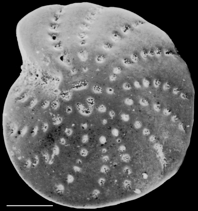 Elphidium charlottense NZ Queen Charlotte Sound topotype Elphidium charlottense NZ Queen Charlotte Sound topotype