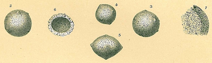 Thurammina albicans