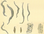 Chromista - Foraminifera (foraminifers)