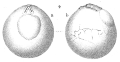 Chromista - Foraminifera (foraminifers)