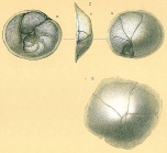 Planulinoides rarescens