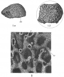 Chromista - Foraminifera (foraminifers)