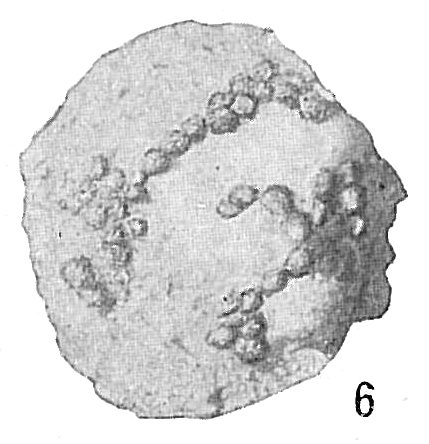 Placopsilina confusa Placopsilina confusa
