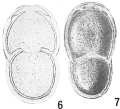 Chromista - Foraminifera (foraminifers)