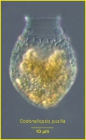 Codonellopsis pusilla (Cleve) Jgensen, 1924 