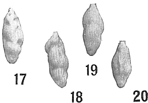 Uvigerina angulosa Uvigerina angulosa