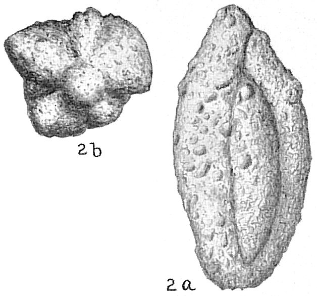 Schlumbergerina alveoliniformis occidentalis