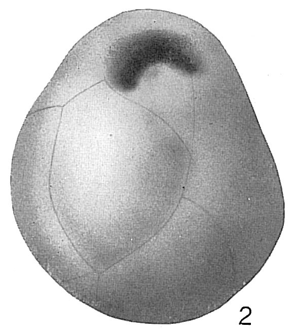 Cassidulina subglobosa