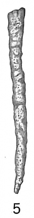 Hyperammina elongata Hyperammina elongata