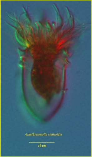 Acanthostomella conicoides Kofoid & Campbell, 1929  AphiaID: 427392 