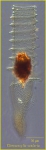 Climacocylis scalaria Brandt, 1906 