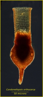 Codonellopsis orthoceras (Haeckel, 1873) Jörgensen, 1924  