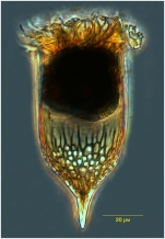 Epiplocylis blanda (Jörgensen 1924) Kofoid & Campbell, 1939   